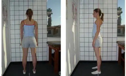 Posture Assessment Is Unreliable in Finding Who Has Low Back Pain