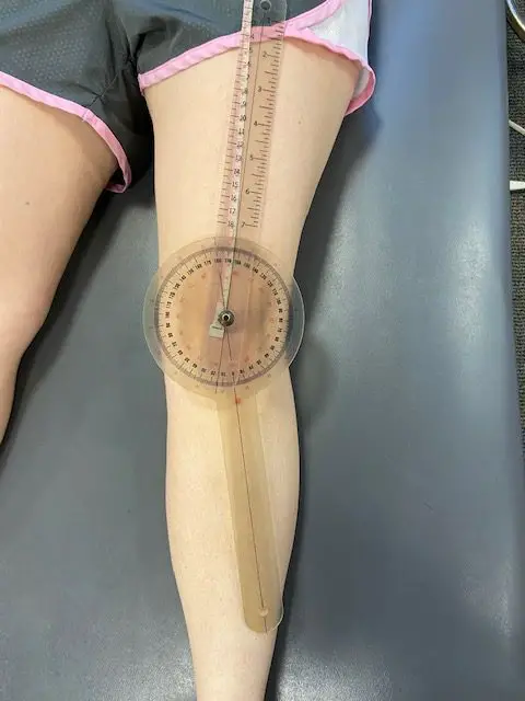a goinometer is used to measure the q angle at the hip and knee