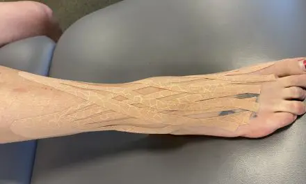 How to Use Kinesio Tape for Your Ankle and Does It Work? (2022)