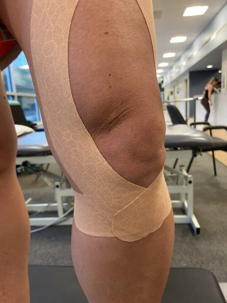 kinesio tape for knee pain