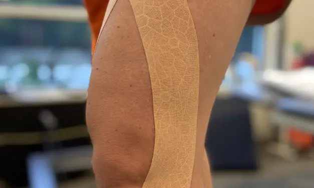 What Is Kinesio Tape and How Does It Really Work? (2022)