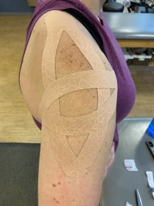 KT Tape for shoulder pain