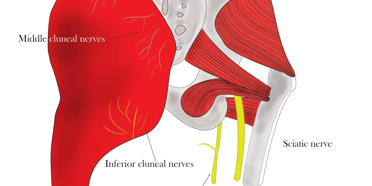 Does Cluneal Nerve Entrapment Really Cause Back Pain? - Massage ...