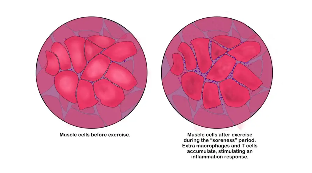 muscle inflammation after exercise in microscope