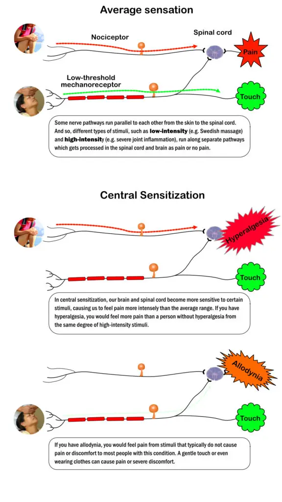 Comparison of the average sensation to nociception and light touch with hyperalgesia and allodynia.